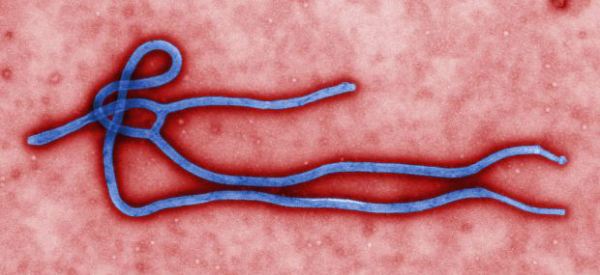 Colorized Ebola Virus (by Cynthia Goldsmith)